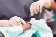 A person having a blood sample drawn from an artery in the arm.