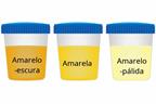 Three cups showing dark yellow, yellow, and pale yellow urine.