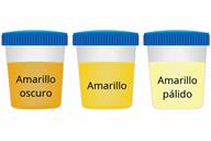 A comparison of three sample cups showing dark yellow, yellow, and pale yellow urine. 