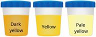 A comparison of three sample cups showing dark yellow, yellow, and pale yellow urine.