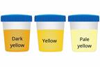 Three cups showing dark yellow, yellow, and pale yellow urine.