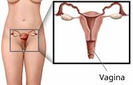 Front view of the female body, with a close-up showing the vagina.