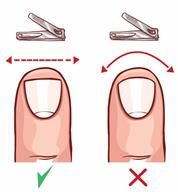 The correct and incorrect way to trim a nail. The correct way is straight across, and the incorrect way is curved.
