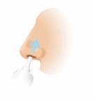 A person's nose with a nasal spray bottle and the upward direction it should enter the nostril.