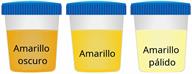 A comparison of three sample cups showing dark yellow, yellow, and pale yellow urine.