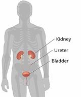 Body outline, showing the kidneys, ureters, and bladder.