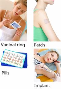 Female contraception options including a vaginal ring, a patch, birth control pills, and an implant.