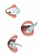 Using a toothbrush to brush the tongue and the front and back sides of the teeth.