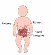 Outline of a baby's body that shows the pylorus, stomach, and small intestine.