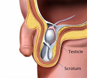 Side view of a male's reproductive organs showing an undescended testicle.