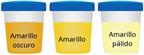 Three cups showing dark yellow, yellow, and pale yellow urine.
