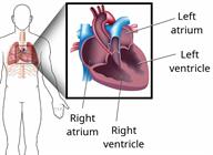 A body outline, with a close-up of the heart, showing the left and right atriums, and the left and right ventricles. 