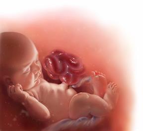 A baby in utero with parts of the stomach and intestines outside of the body.