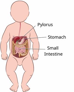 An infant, showing the pylorus, as well as the stomach and the small intestine.