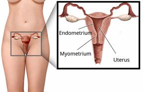 Female body, with a close-up showing the endometrium, myometrium, and the uterus.