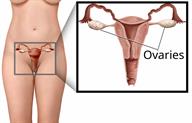 Female body area with a close-up showing the ovaries.