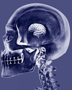 Lack of Sleep May Shrink Your Brain Lack of Sleep May Shrink Your Brain