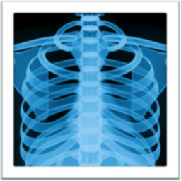 x-ray emoji