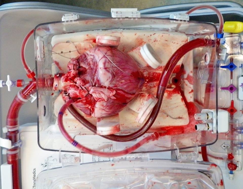 Transmedics AngelList