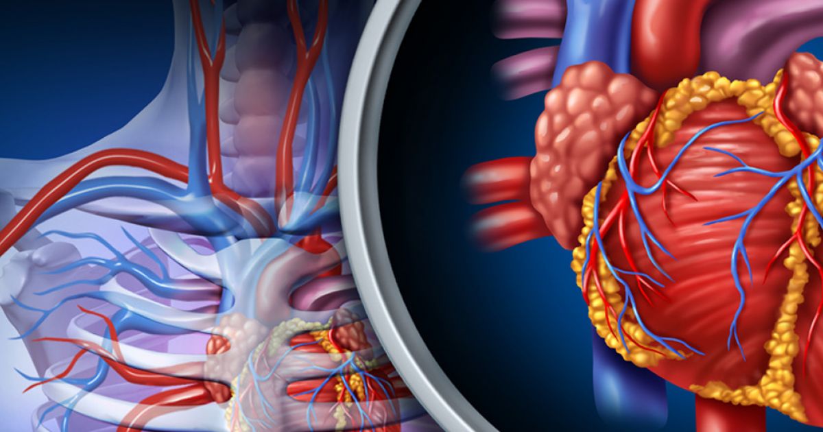 Por Dentro Salud Los infartos son cada vez más