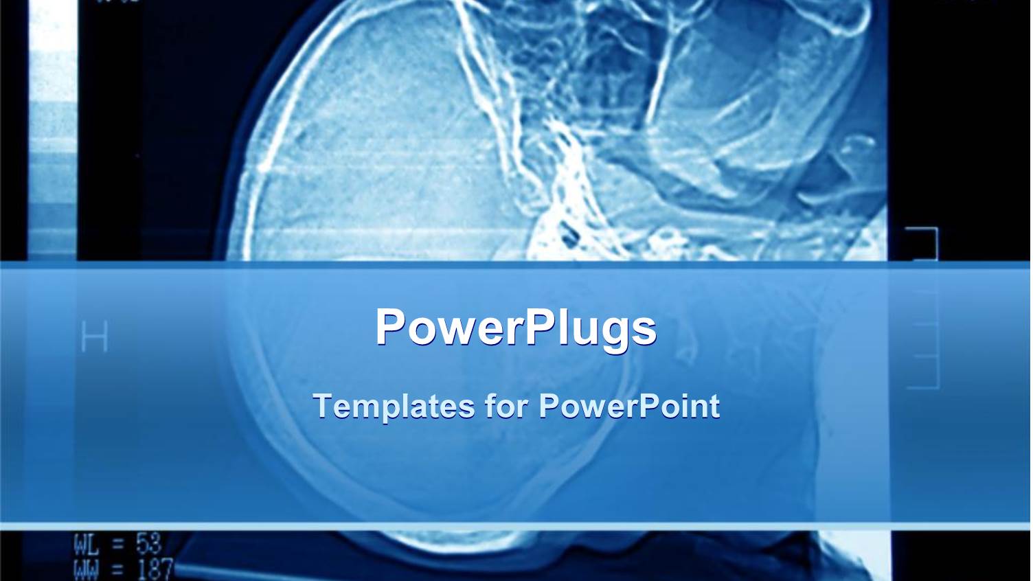 Black and Blue X-ray of a Human Brain