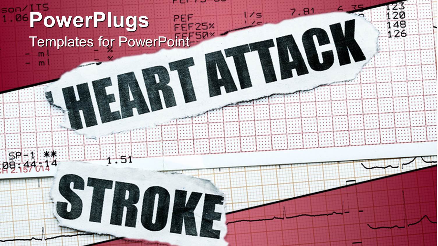 a Depiction of the ECG Report Along with Mentioning Heart Attack and Stroke