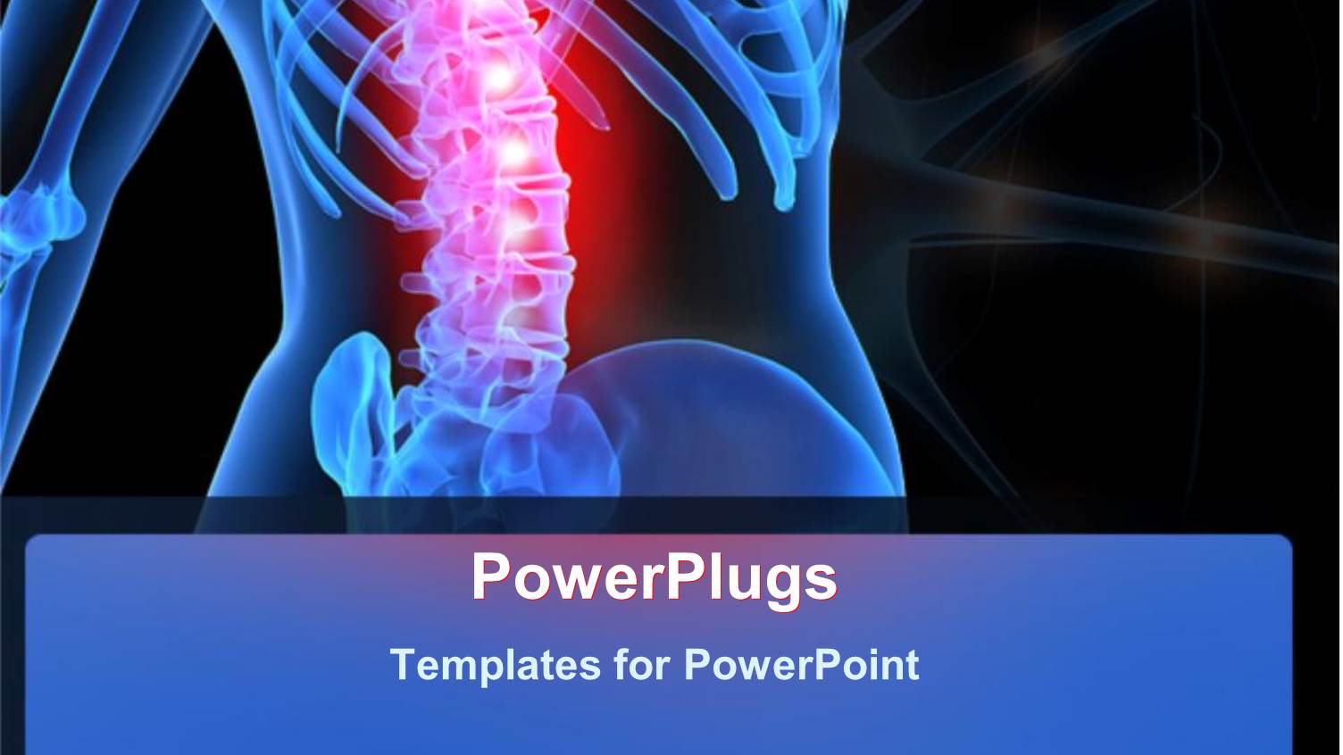 Human Anatomy Showing Inflamed Spinal Column