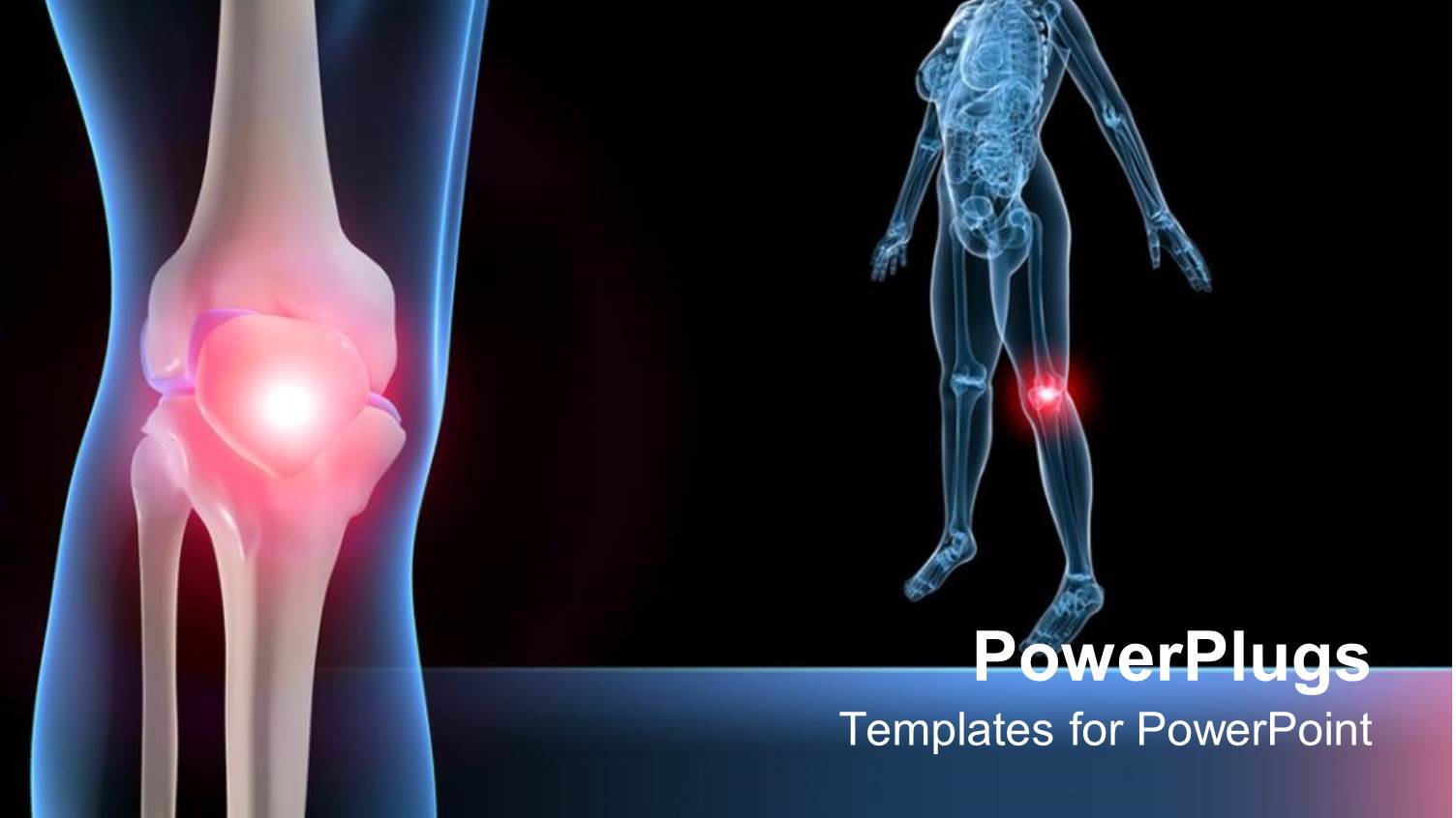 Human Anatomy X Ray, Full Body and Close Up of Knee Pain