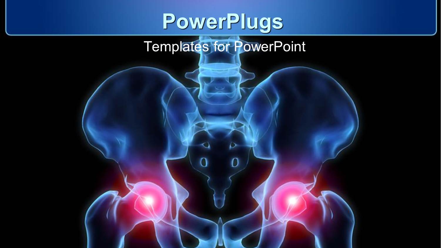 Human Pelvis with Inflamed Hip Joints on Black Background