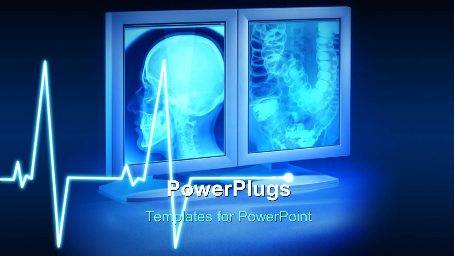 large X-Rays Viewed on Hospital High End Monitors with Ecg Wave in Background