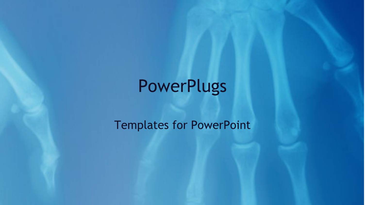 X-ray of Human Hands Showing Skeleton of Hand Fingers