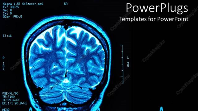  Presentation with blue brain - Blue brain MRI, black background, brain scan
