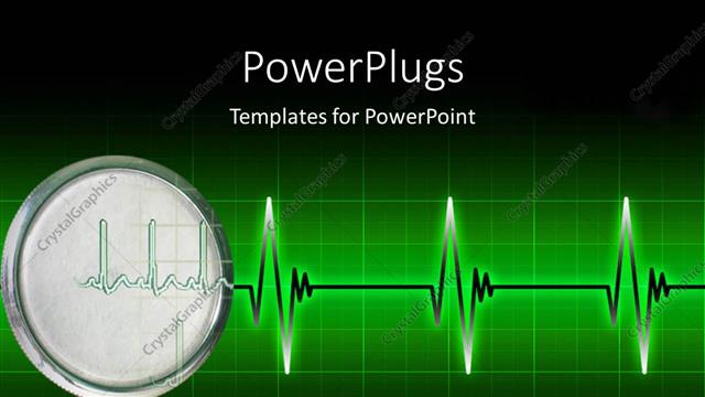  Presentation with ecg - Cardiogram pulse on bright green gridlines with dark edges
