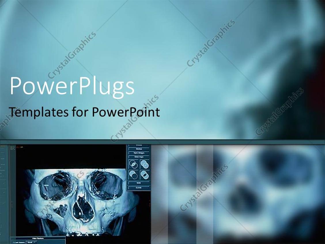 PowerPoint Template: digital x ray of skull (20) For Radiology Powerpoint Template PowerPoint Template: digital x ray of skull (20) For Radiology Powerpoint Template