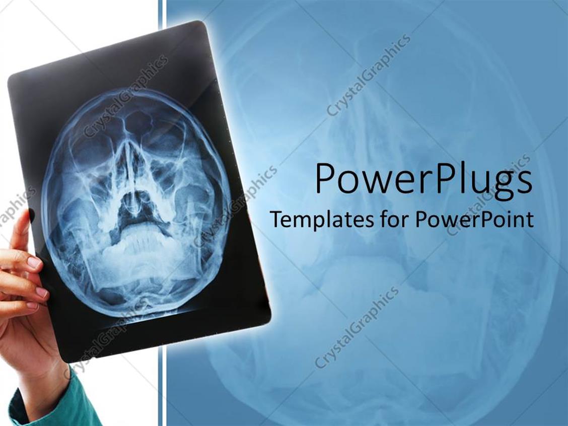PowerPoint Template: Hand holding up X-ray scan of human skull for Inside Radiology Powerpoint Template PowerPoint Template: Hand holding up X-ray scan of human skull for Inside Radiology Powerpoint Template