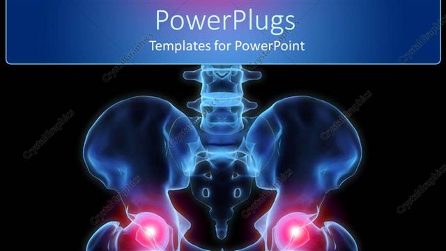  Presentation with joints - Human pelvis with inflamed hip joints on black background