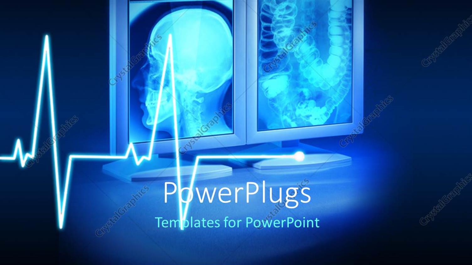 PowerPoint Template: Large X-rays viewed on hospital high end Inside Radiology Powerpoint Template PowerPoint Template: Large X-rays viewed on hospital high end Inside Radiology Powerpoint Template