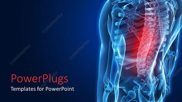  Presentation with area - Red highlighted middle back area of a human spine