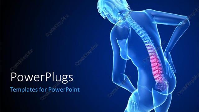  Presentation with backache - Scan of female person showing spine on blue background