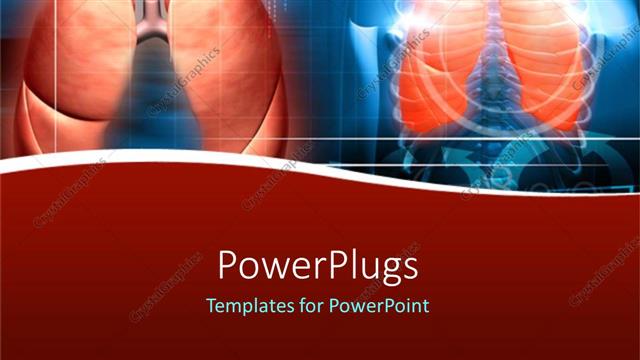  Presentation with ribs - X-ray of human body showing ribs and lungs