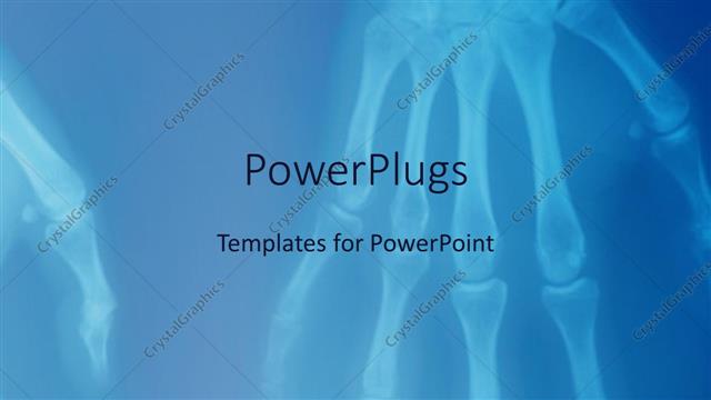  Presentation with medical hand - X-ray of human hands showing skeleton of hand fingers