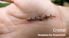  Presentation with carpal tunnel - Slides enhanced with a carpal tunnel syndrome background and a coral colored foreground