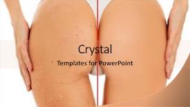  Presentation with acne - Slide set having acne - closeup shot of female buttocks background and a coral colored foreground