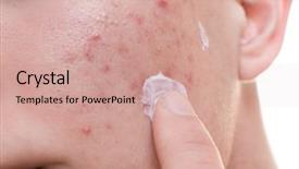  Presentation with cream - Slide set featuring acne - young man applying cream background and a coral colored foreground