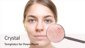  Presentation with acne - Audience pleasing presentation theme consisting of acne and skin care concept backdrop and a lemonade colored foreground