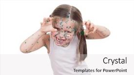  Presentation with acne - Slide deck enhanced with acne on child chickenpox background and a  colored foreground