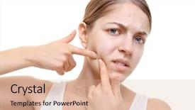  Presentation with beautiful young woman getting face - Cool new slide set with acne vulgaris - beautiful young woman popping pimples backdrop and a  colored foreground