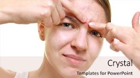  Presentation with acne vulgaris - Audience pleasing presentation theme consisting of acne vulgaris - beautiful young woman popping pimples backdrop and a coral colored foreground