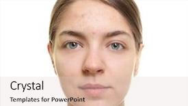  Presentation with beautiful skin and beach - Beautiful presentation design featuring acne vulgaris - beautiful young woman with problem backdrop and a  colored foreground