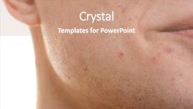 Presentation with skin - Presentation theme consisting of acne vulgaris - face of handsome young man background and a coral colored foreground